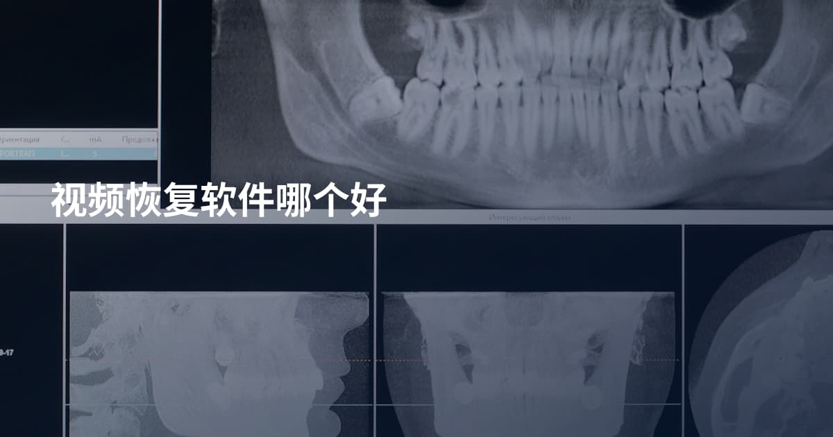 视频恢复软件哪个好