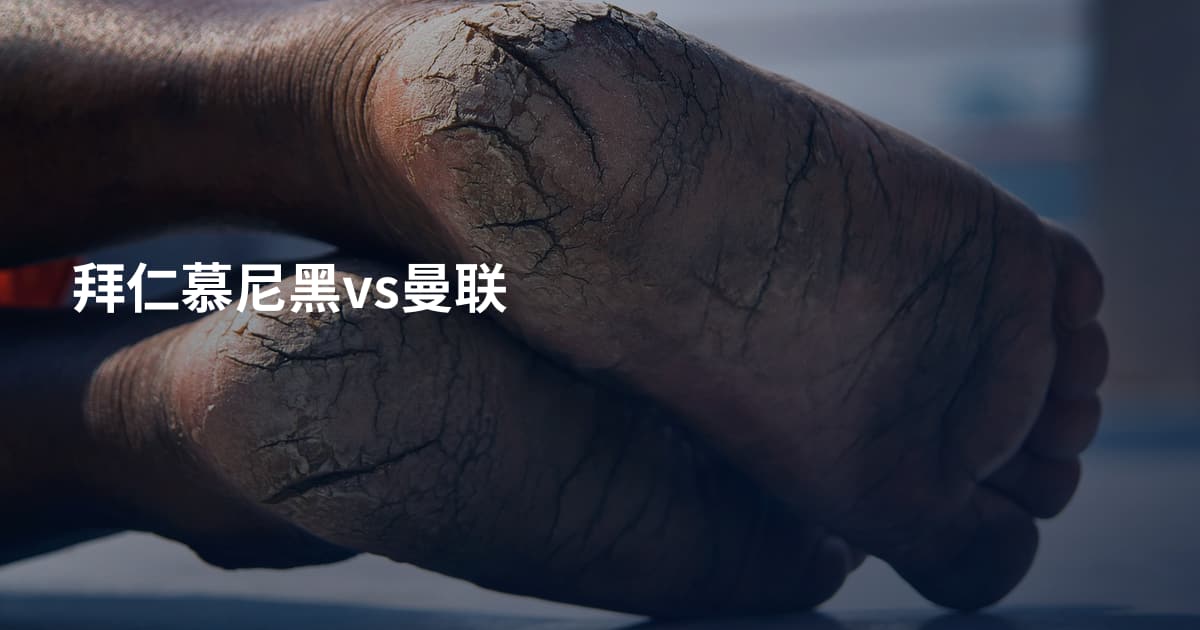 拜仁慕尼黑vs曼联
