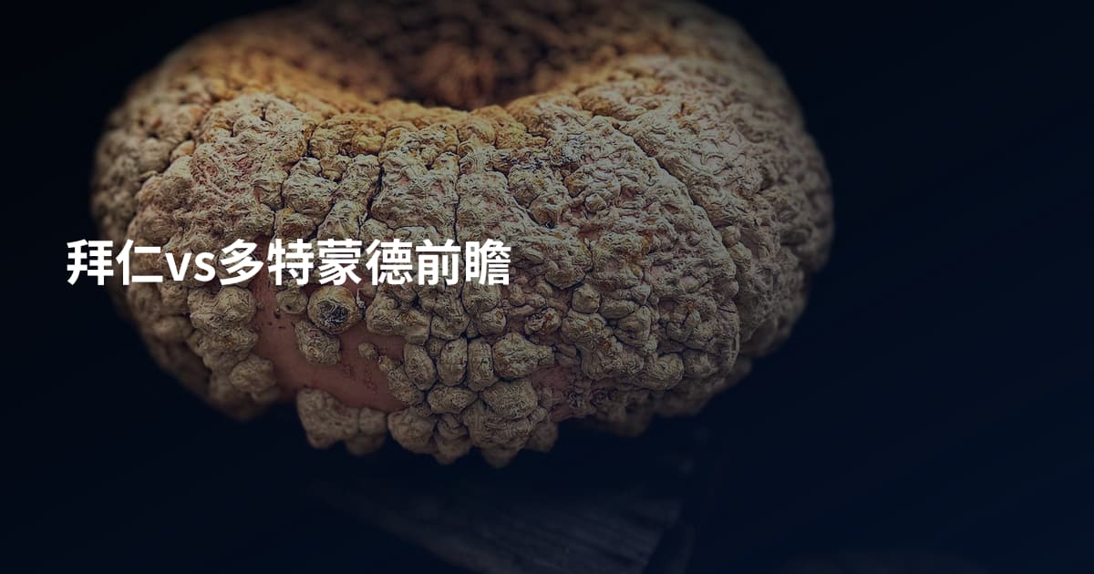 拜仁vs多特蒙德前瞻